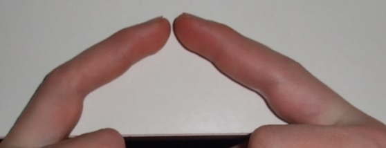 Schmerzen Im Mittelfinger Schmerzen Im Mittelfinger