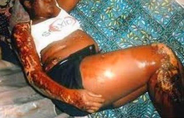 Man sets wife Ablaze for giving birth to only Female Children in Ebonyi