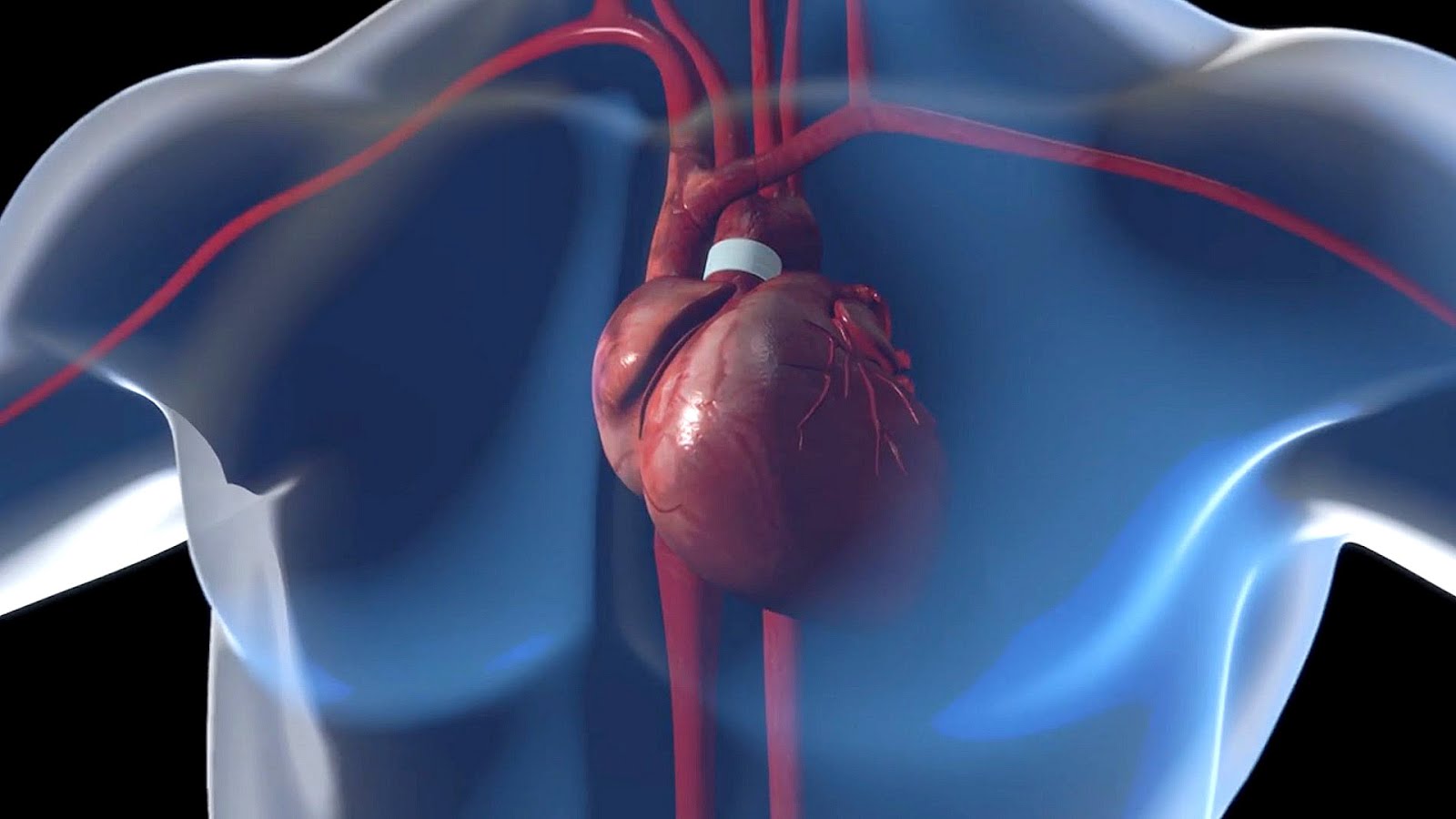 What Pumps Blood To The Heart Hear Choices