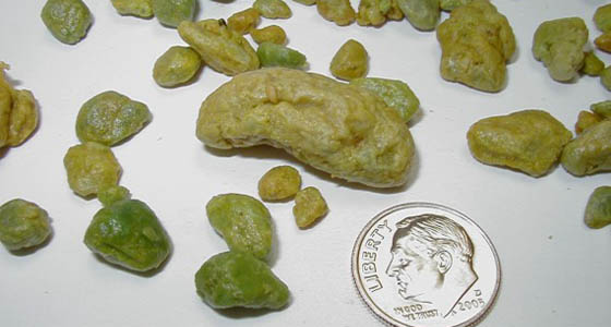 Kamen u žuči, proveren recept za prirodno uklanjanje Kamen u žuči, proveren recept za prirodno uklanjanje