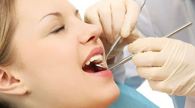 Có nên bọc răng sứ cho răng sâu hay không?