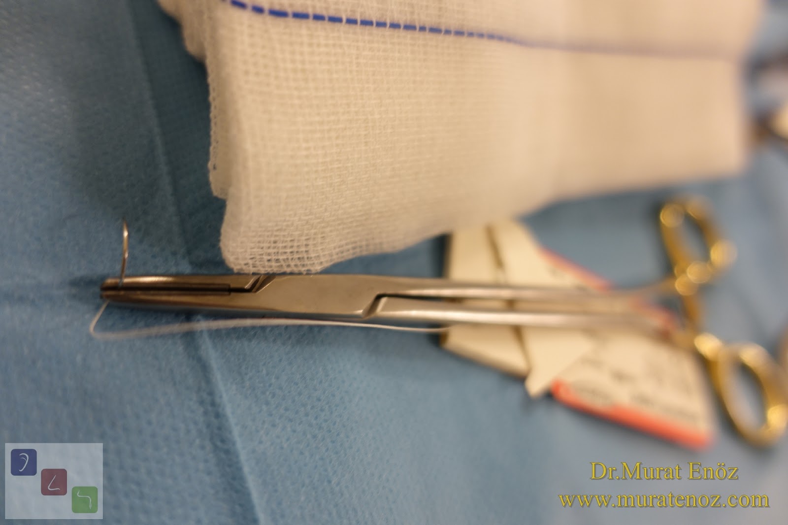 Bademcik Ameliyatı ve Geniz Eti Ameliyatı Kimler İçin Gereklidir?