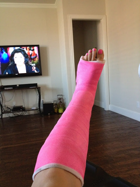 Casts and Toes: Some Short Leg Cast Pics