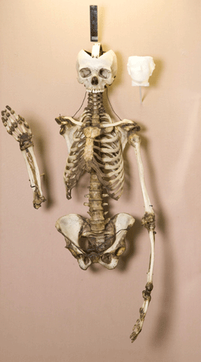 The skeleton of Mary Bateman, "The Yorkshire Witch"