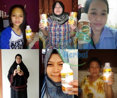 Obat Gejala Alzheimer Di Usia Muda