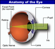 Understanding Williams Syndrome: Eyes