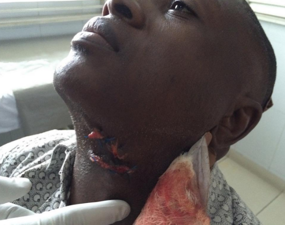 1 Close-up pic of stab wound sustained by Channels TV reporter
