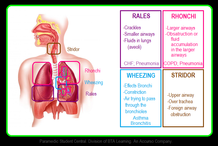 Paramedic Student Central: Lung Sounds Reference Chart