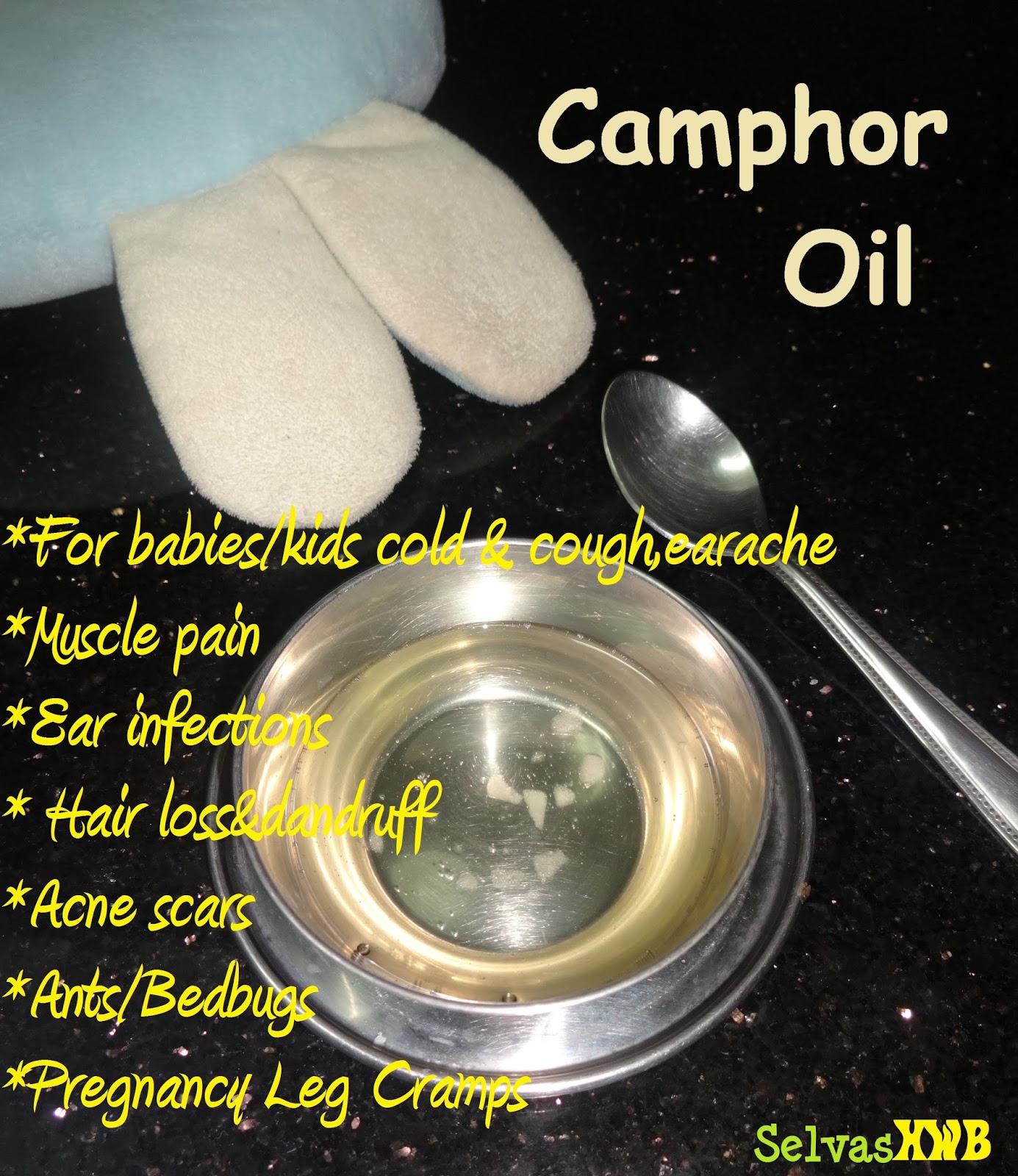 Lista 96+ Imagen Does Camphor And Kerosene Kill Lice Eggs Lleno