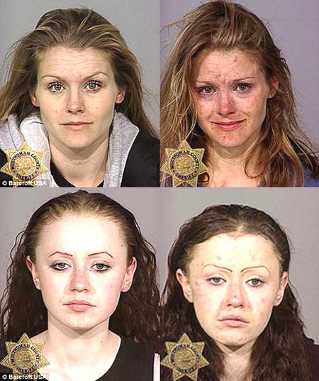 Smile Drug Addiction Before And After smile-drug-addiction-before-and-after