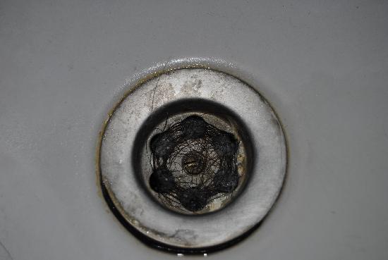 5 PARA TODO: 5 posibles falsas señales de calvicie