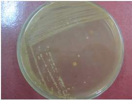 MEDIA PERTUMBUHAN MIKROBA | YANJUZ