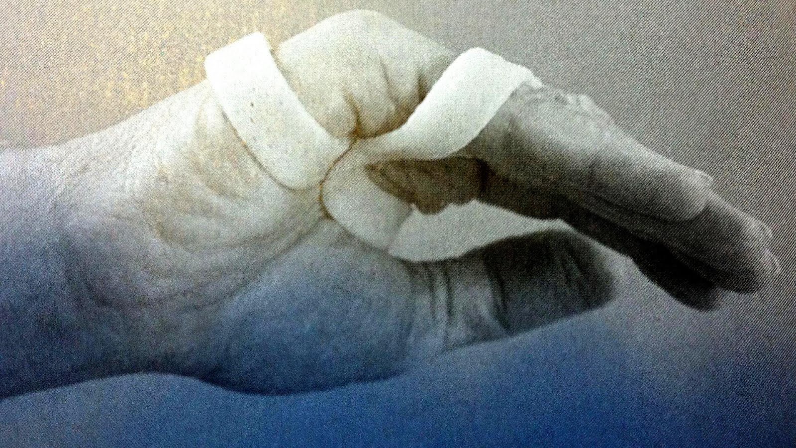 Ulnar Nerve Injury Splint Injury Choices