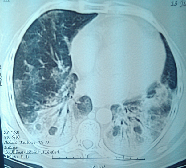 EL RINCÓN DE LA MEDICINA INTERNA. juanpedromacaluso@yahoo.com.ar ...