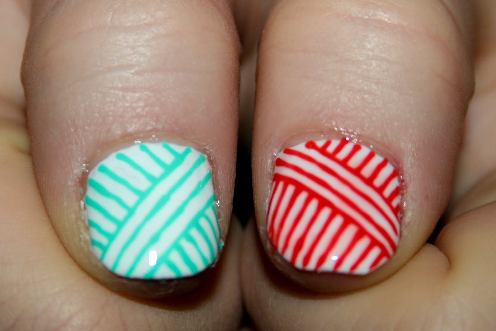 What Are Nail Ridges: Are They A Sign Of A Health Problem ...