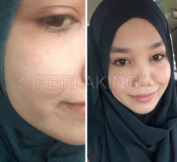 testimoni perla king serbuk mutiara