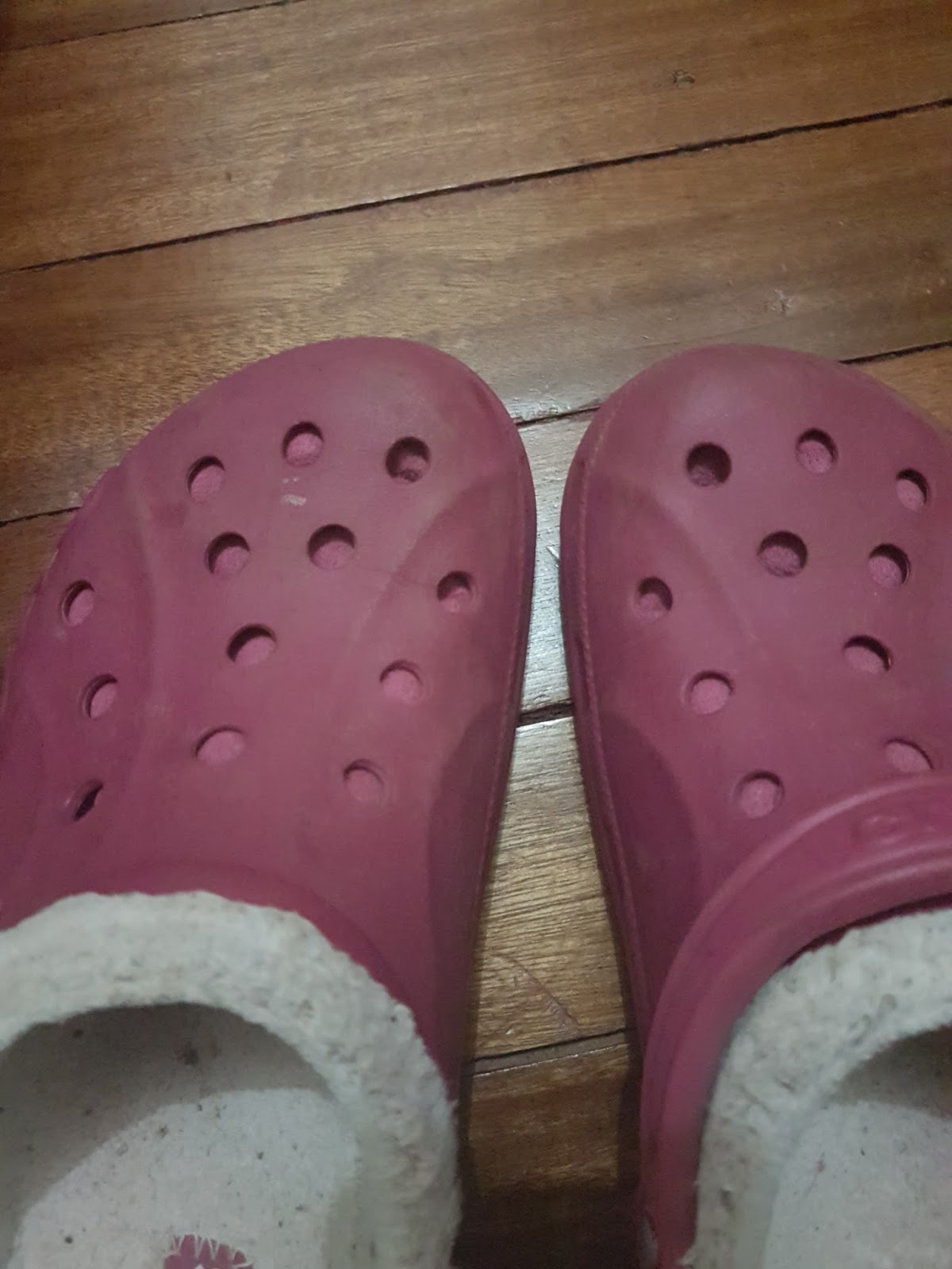 athlete's foot crocs