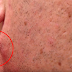 MUST WATCH: A Man Decided To Pull Out His Curled Hair On His Face And An Unexpected Thing Happened!