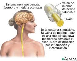mielina alimentos coeduweg regenerar la mielina y nutrir el cerebro mielina alimentos coeduweg regenerar la mielina y nutrir el cerebro