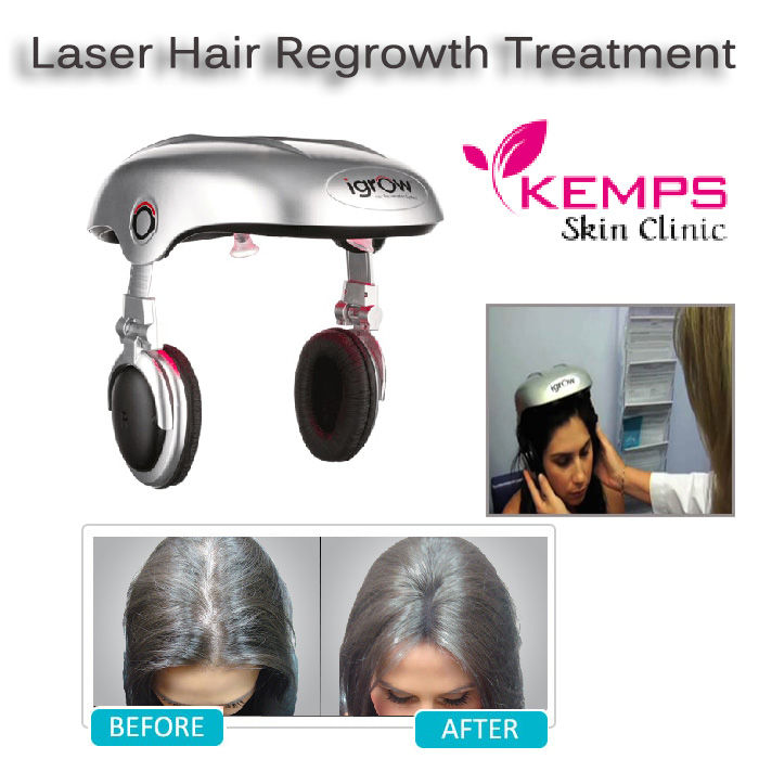 Know about laser hair regrowth treatment and its procedure KEMPS