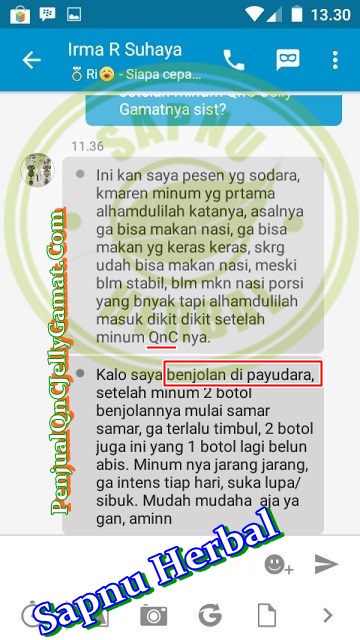 Cara Cepat Menghilangkan Benjolan Kecil di Pangkal Paha Sampai Tuntas Cara Cepat Menghilangkan Benjolan Kecil di Pangkal Paha Sampai Tuntas