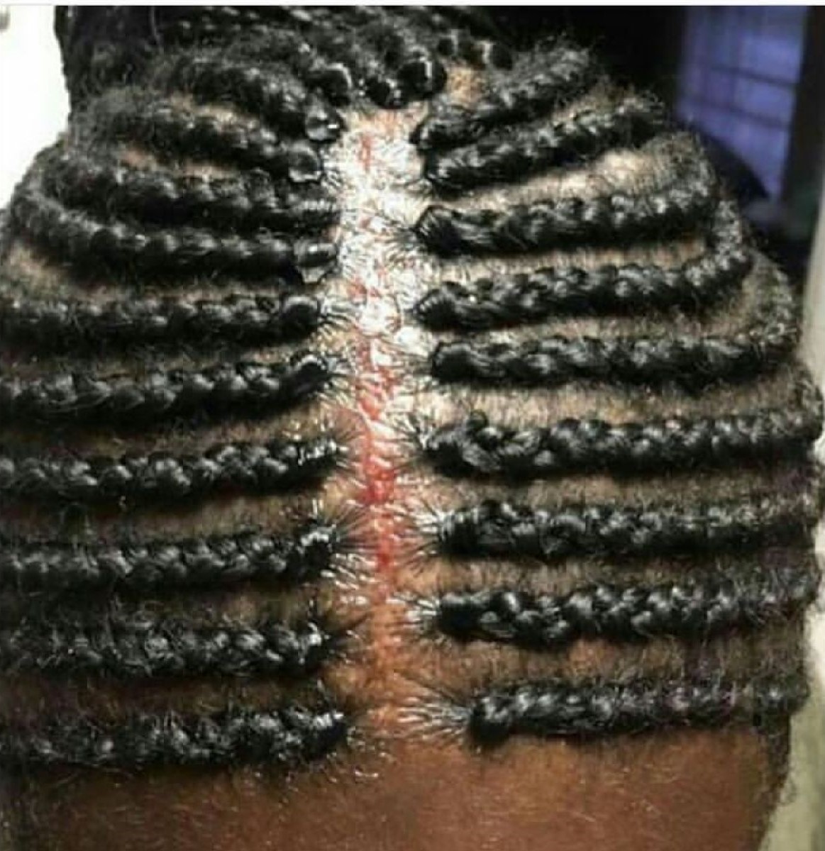 Internet Shocked Over Bloody Scalp And Braids Photo internet-shocked-over-bloody-scalp-and-braids-photo