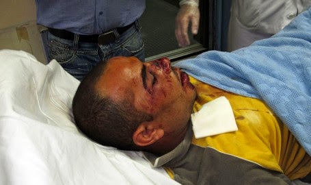 Δολοφονική επίθεση στους Αιγύπτιους αλιεργάτες