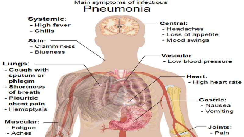 CLINICAL FEATURES OF PNEUMONIA