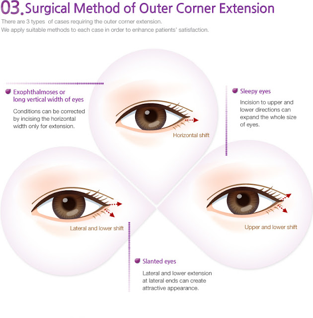 BK Plastic Surgery ADVANCED EXPERTISE IN EYELID SURGERY