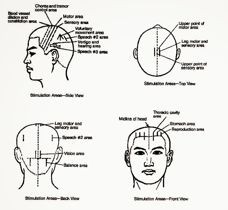 Acupuncture: Acupuncture Microsystems and Reflections on the