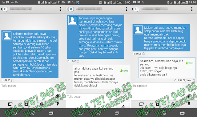 testimoni obat kutil kelamin de nature