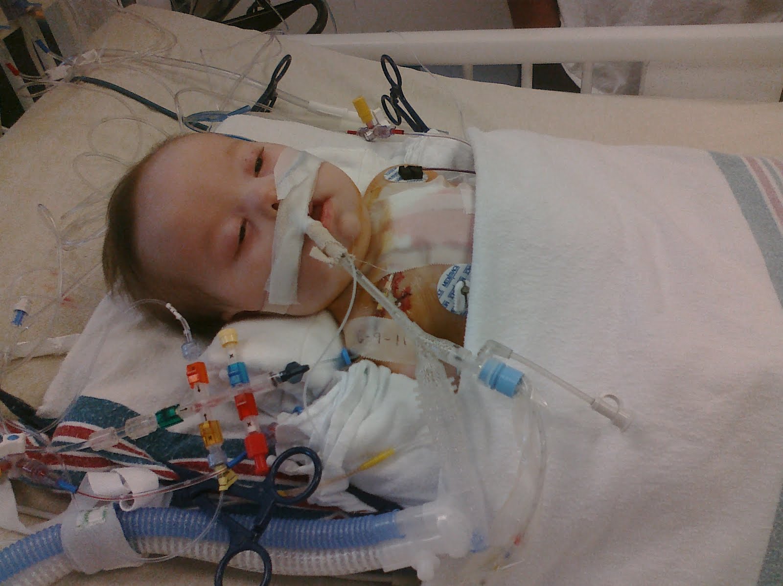 The House That Jade Built Open Heart Surgery Day 1