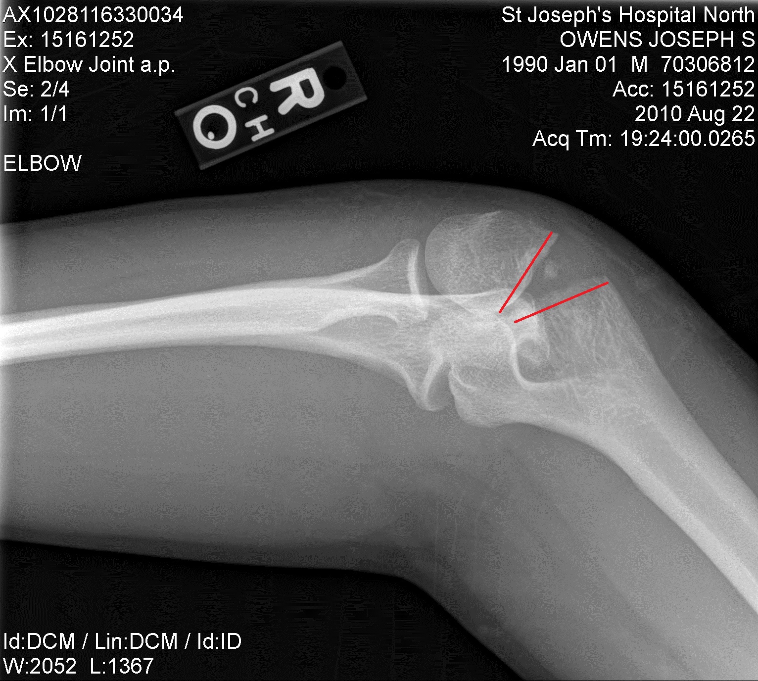 A World Amongst Us The formality of introducitions...