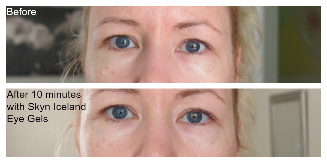 SKYN ICELAND HYDRO COOL FIRMING EYE GELS DO THEY WORK?
