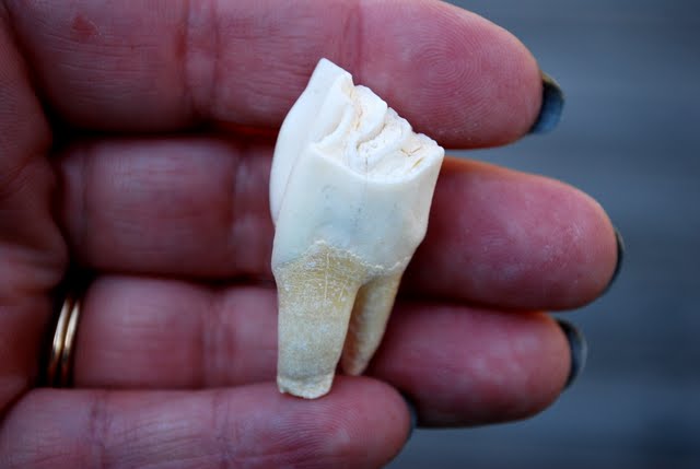 Bittersweet Bric-a-Brac: A Collection of Teeth???