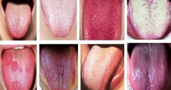 Here's What The Color Of Your Tongue Reveals About Health | Savvy Life Mag
