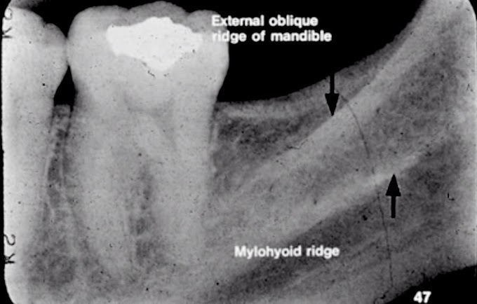 WEBINAR: Dental Radiographic Anatomy - Melanie Helmke