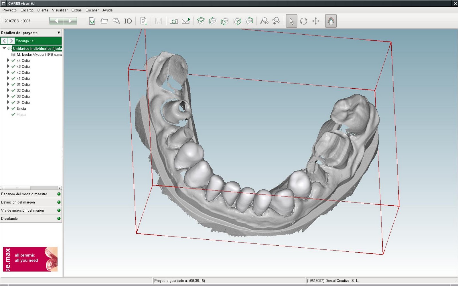 Odontología sin chorradas: CAD-CAM, suena muy tecnológico... Parte 1.