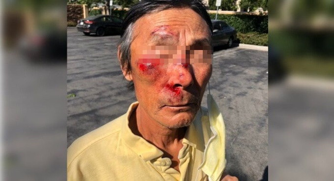 이미지에 대체텍스트 속성이 없습니다; 파일명은 159ppp4w886q5zgw3648.jpg 입니다.