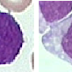 Leukemic Cells Short Notation