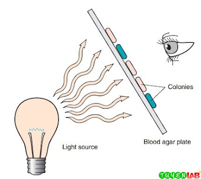 The use of transillumination to determine whether the colonies are hemolytic. The technique can be used for MacConkey agar also to see slight color differences in nonlactose fermenters. The use of transillumination to determine whether the colonies are hemolytic. The technique can be used for MacConkey agar also to see slight color differences in nonlactose fermenters.
