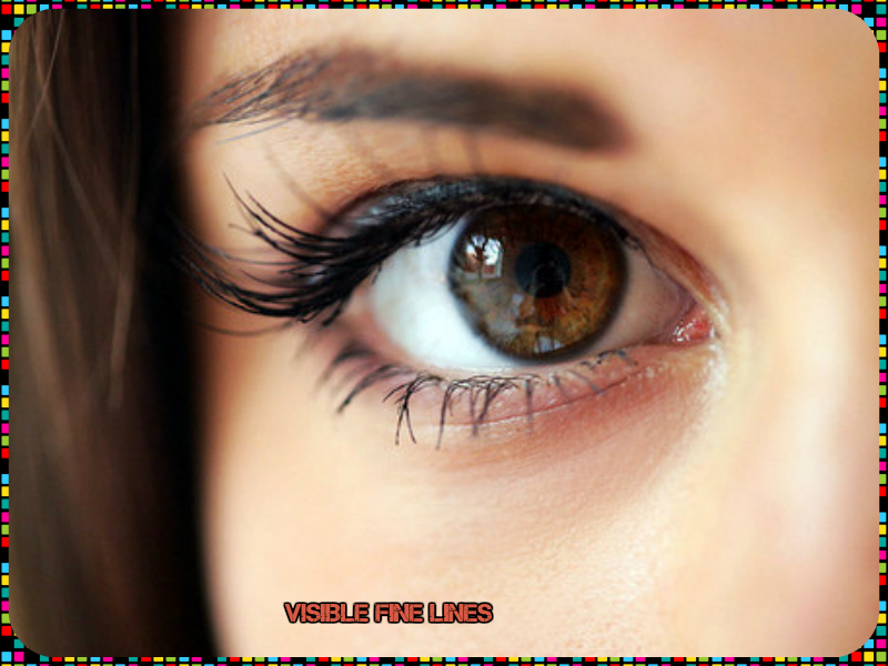 remove lines under eyes