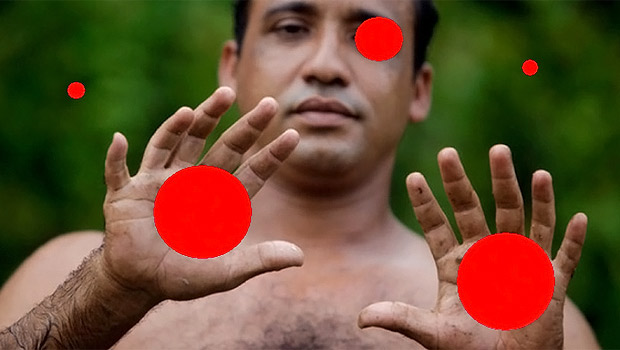 Üzerinde beş kırmızı nokta olan ve ellerinde altı parmağı olan bir adam resmi