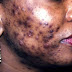 4 Signs You Did It With Someone Who Is HIV Positive Very Recent | Health