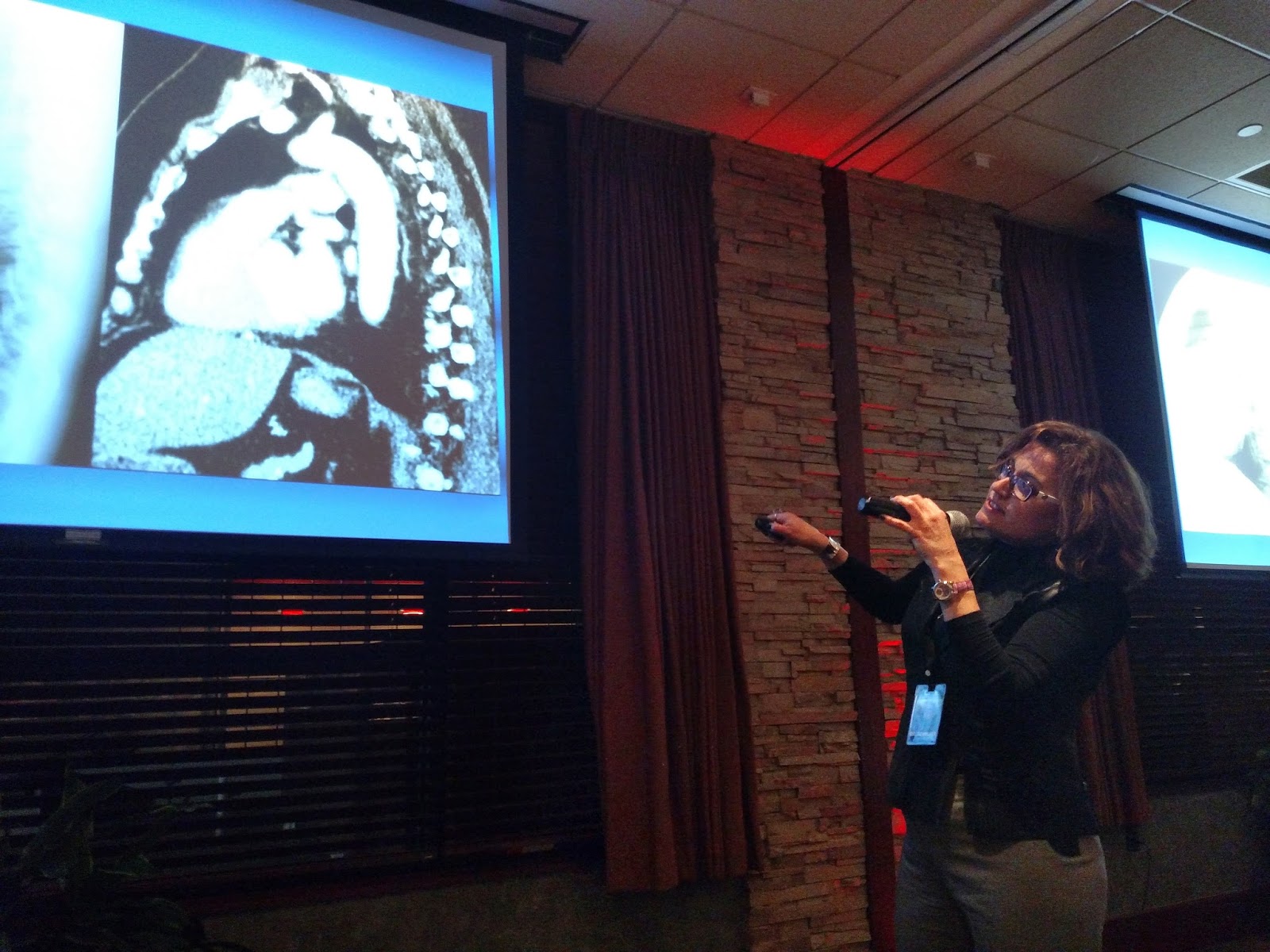 Putting Patients First ZwangerPesiri Hosts a Dinner at Seasons 52