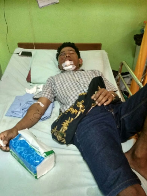 Tanpa Pengamanan, Pekerja Proyak SMPN 1 Bunguran Terjatuh Ketianggian 10M