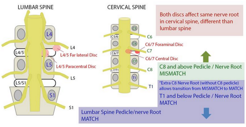Medical Student Sharing: Complete/Incomplete Spinal Cord injury