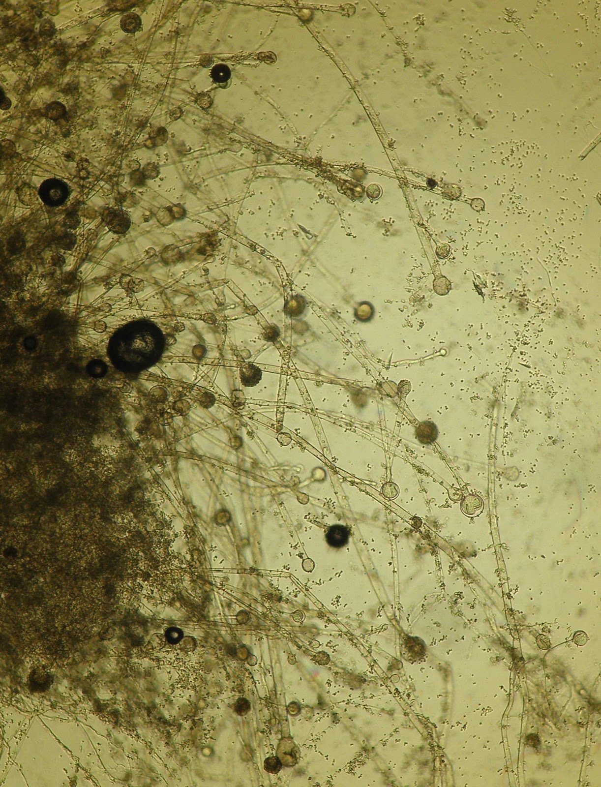 Мукор клетка. Ткань плесени мукора. Клетка мукора под микроскопом. Плесень мукор под микроскопом. Mucor под микроскопом.