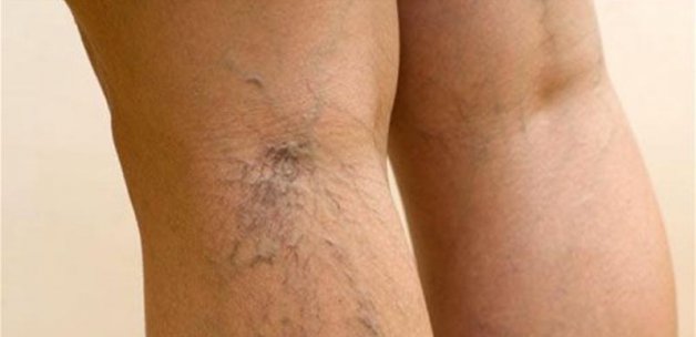 Varis Icin Hangi Doktora Gidilir