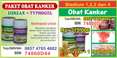 cara pemesanan di apotik cara mengatasi kanker paru mesothelioma, cari apotik cara mengatasi kanker denature rahma herbal, telpon apotik cara cepat mengempiskan kanker payudara ebook